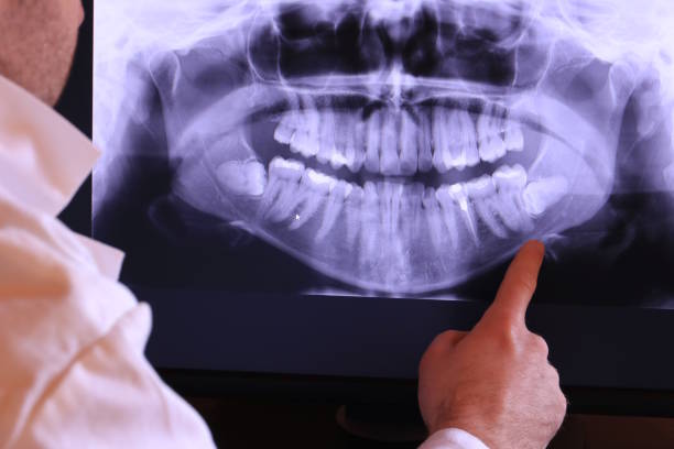 Best Emergency Care for Gum Disease in Portage, IN